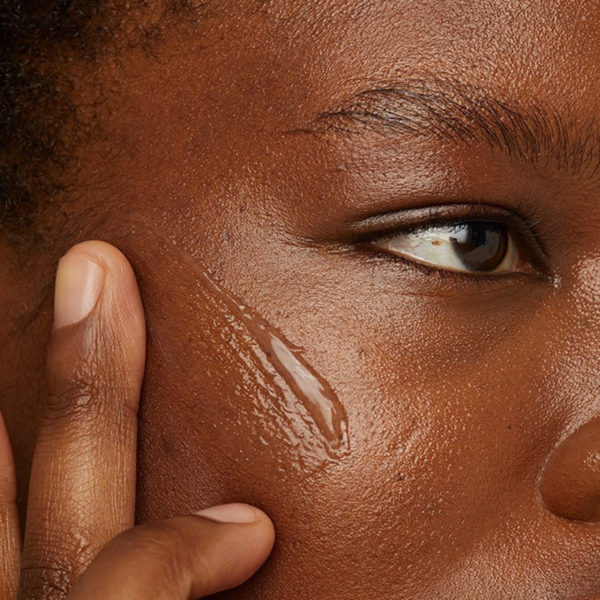 best treatments for hyperpigmentation