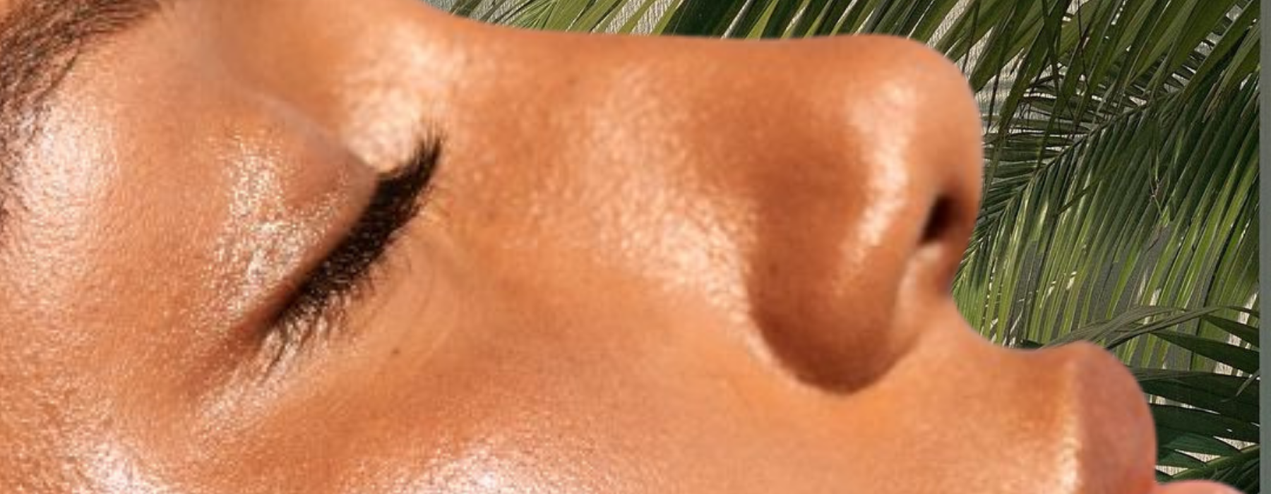 en-route hormonal imbalance acne