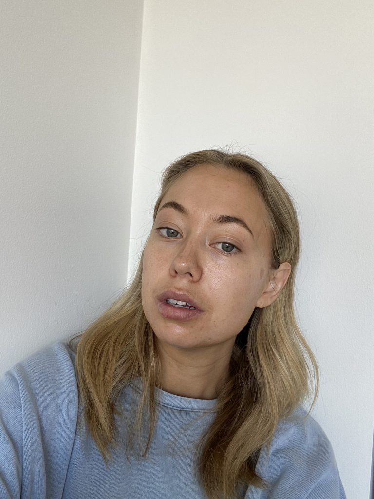 Anti ageing peel en-route