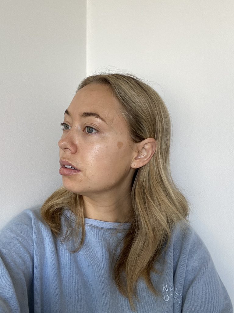 Anti ageing peel en-route